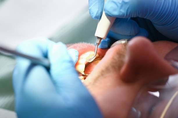 Best Emergency Dental Care for Sports Injuries in Arroyo Seco, NM